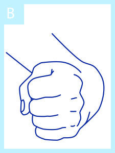Grafik_Spastik_Arm-Handbereich